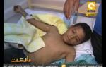مانشيت: قطع قدم الطفل " فارس " أثناء محاولة إغتيال وزير الداخلية